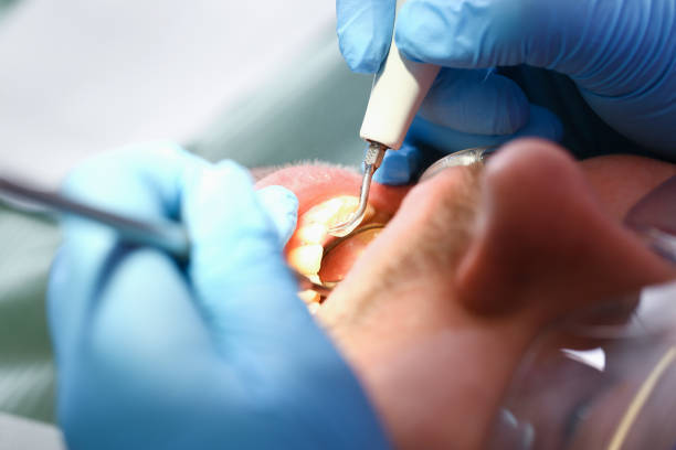 Best Emergency Dental Services for Seniors in Point Venture, TX