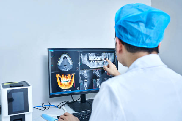 Best Emergency Root Canal Treatment in Point Venture, TX